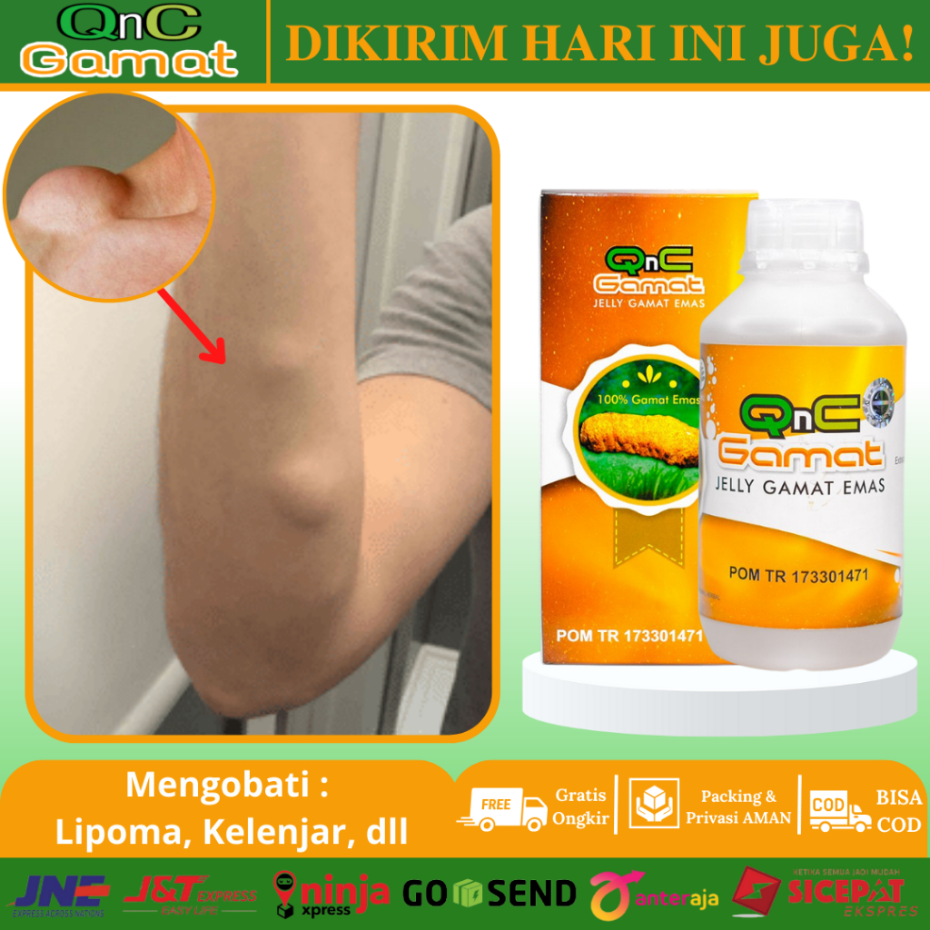 Jual Obat Benjolan Lipoma, Benjolan Lemak, Benjolan Di Leher, Kepala ...