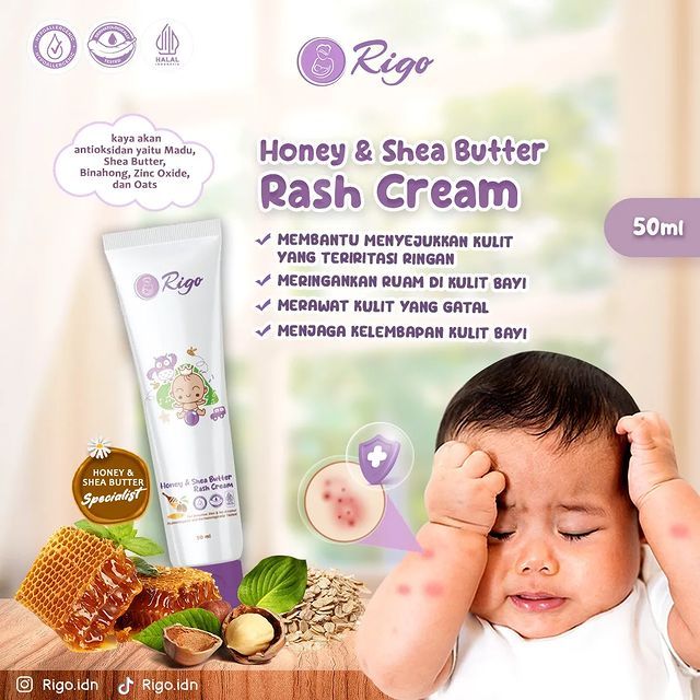 Jual Rigo Honey & Shea Butter Rash Cream Baby 50ML Momandchild Shopee