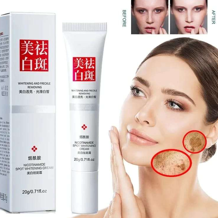 Jual Laris FUYAN Nicotinamide Spot Whitening Cream Fu Yan Whitening And Freckle Removing