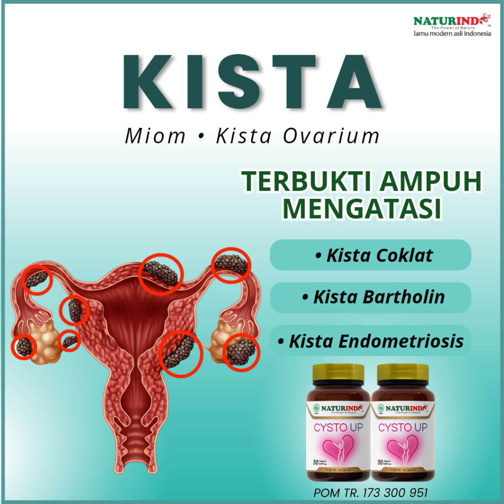 Jual Obat Kista Miom Coklat Bartholin Endometriosis Bartholin Ovarium ...