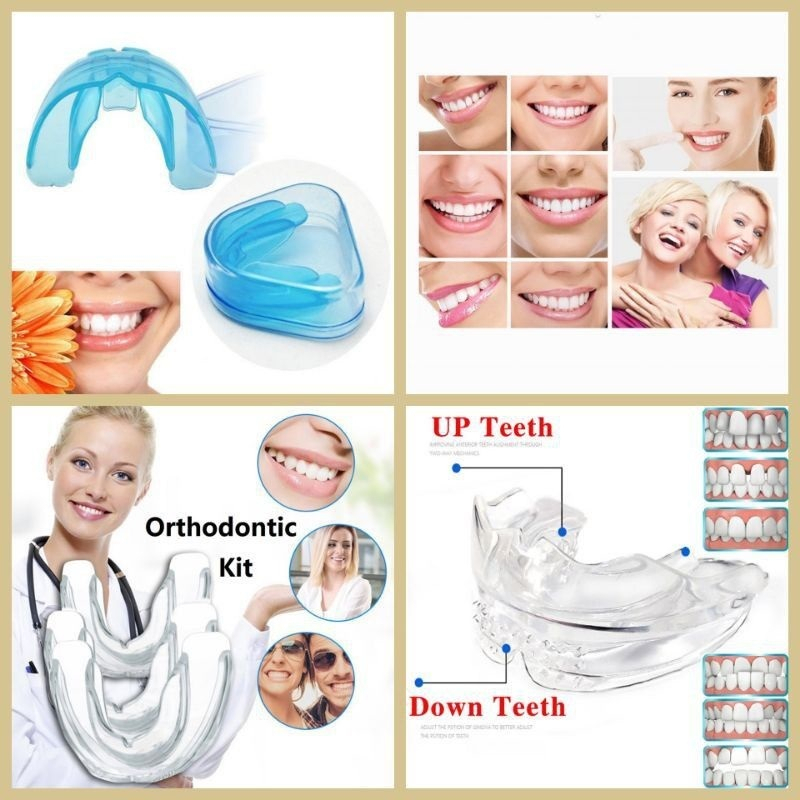 Jual Teeth Trainer Allignment Orthodontic Alat Perapih Gigi | Shopee ...