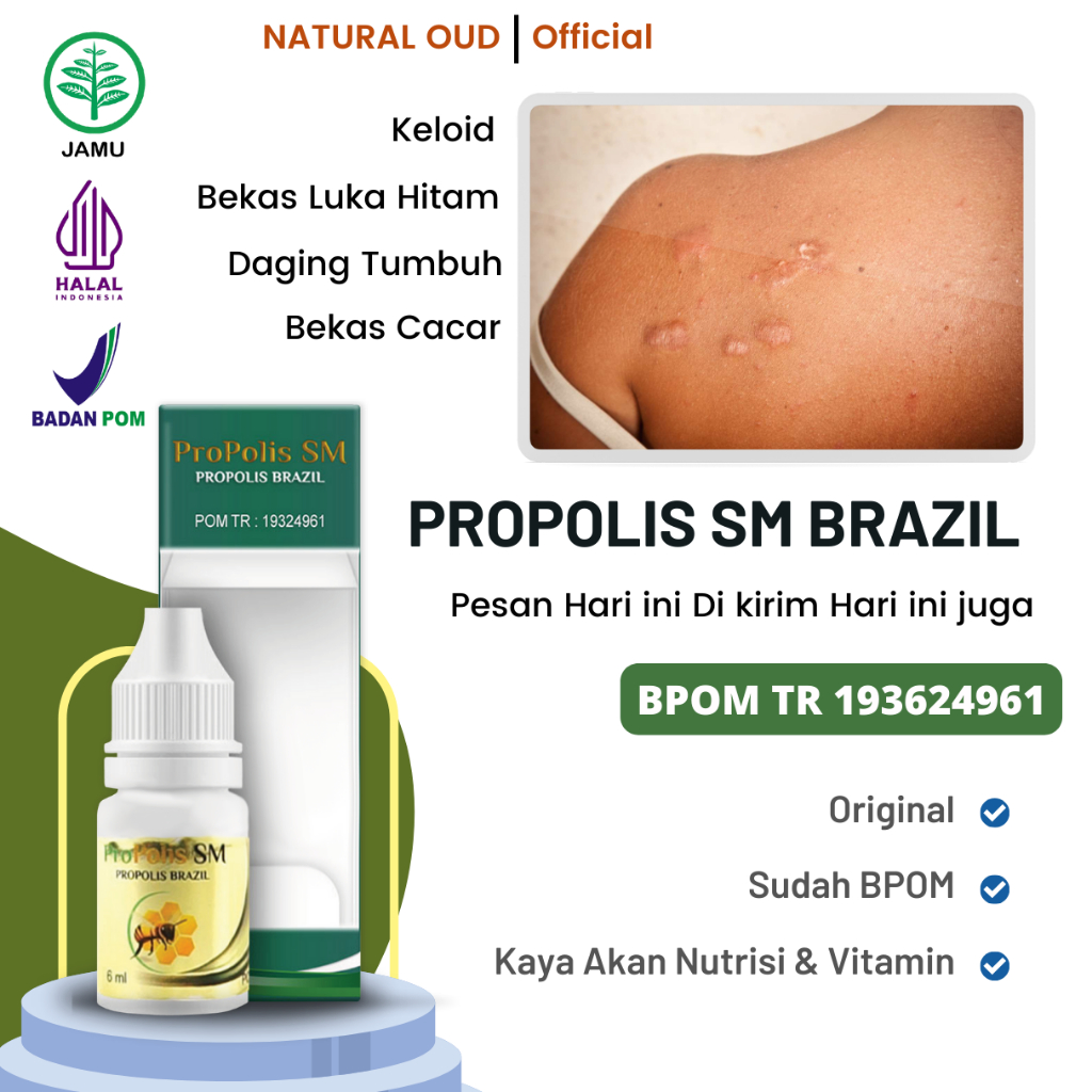 Jual Obat Keloid Penghilang Bekas Luka Hitam Koreng Obat Keloid Luka