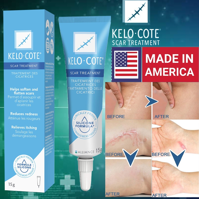 Jual KeloCote Scar Gel 15g /Kelo Cote Topical Advanced Formula Scar