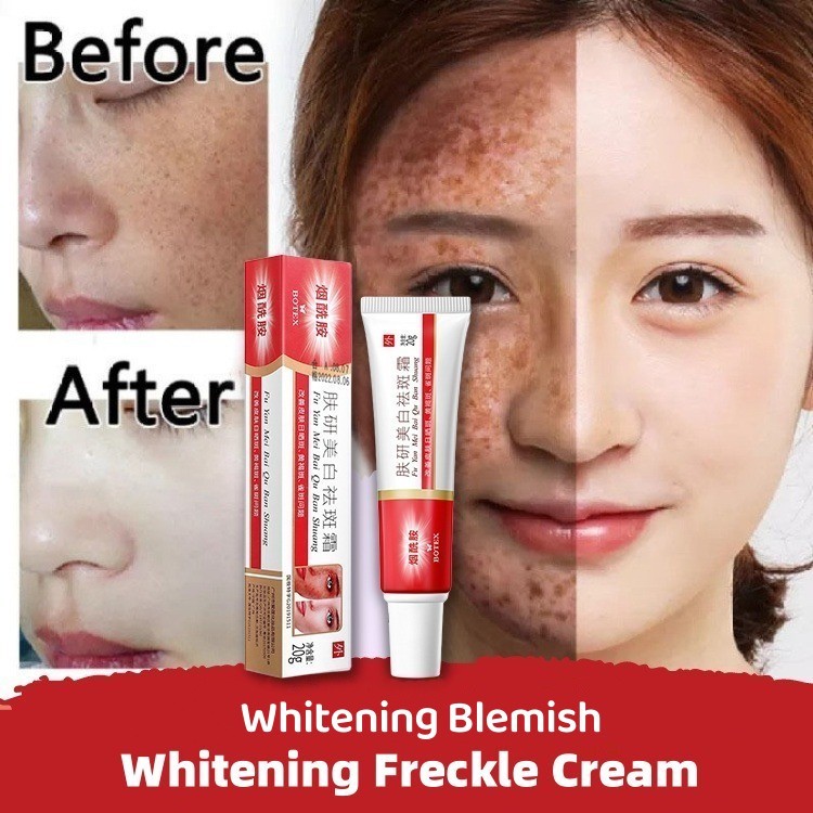 Jual BEOTUA Whitening Freckle Cream Whitening Blemish G Cream Penghilang Flek Hitam Dan Krim