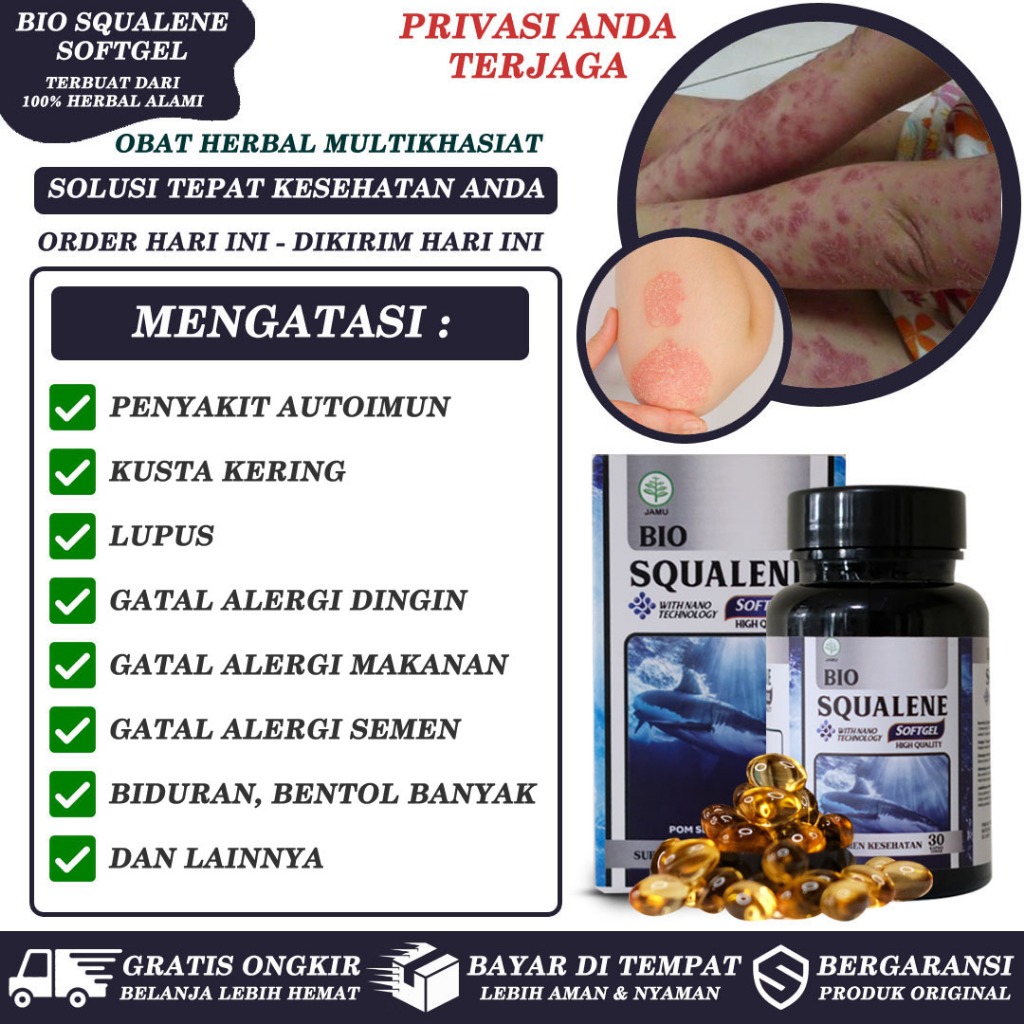 Jual Obat Autoimun Lupus Kusta Kering Alergi Gatal Kulit Akibat Dingin