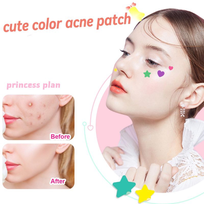 Jual Acne Patch Pimple Patch Stiker Jerawat berwarna-warni Cute Star