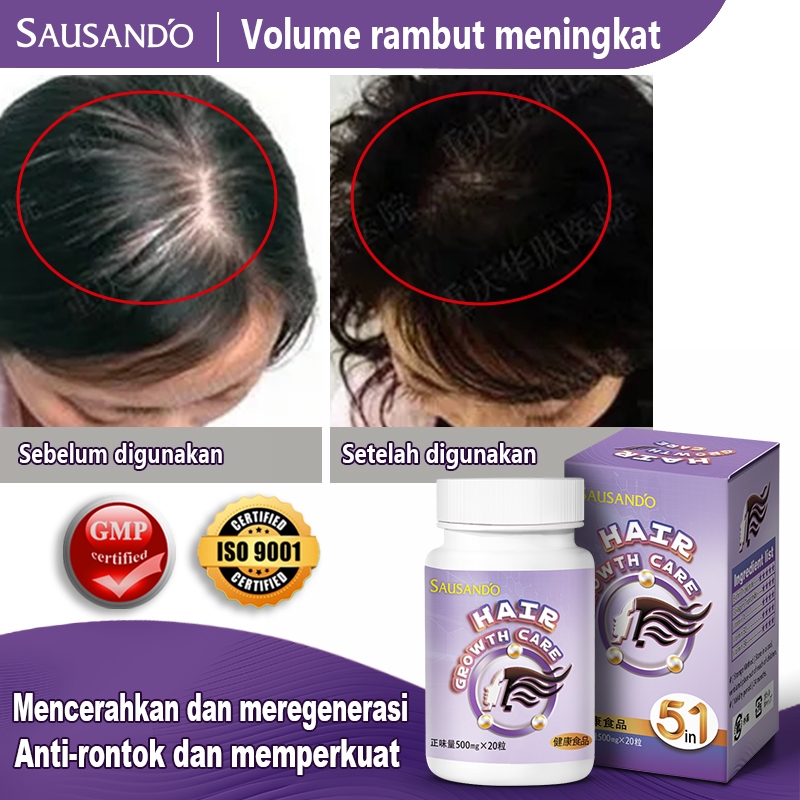Jual Kapsul rambut mentah / perlindungan kepala botak / perlindungan ...