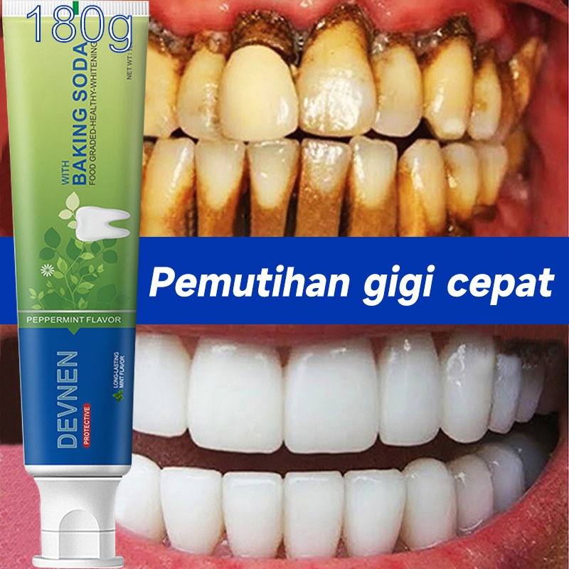 Jual gigi Whitening Toothpaste180g gigi penghilang karang pasta gigi ...