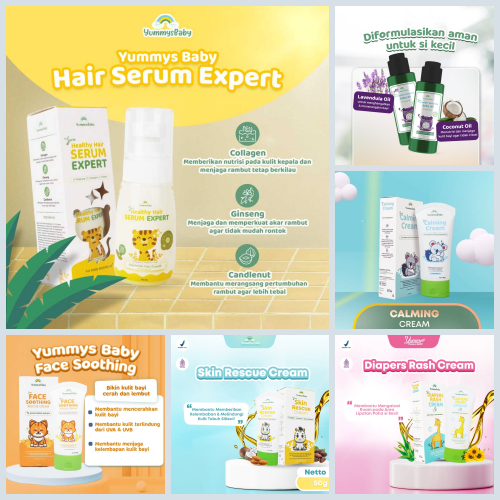 Jual PERA645 YUMMYS BABY HAIR SERUM EXPERT PENUMBUH RAMBUT BABY 70ML ...