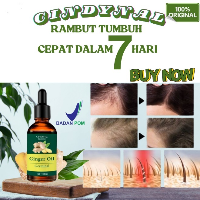Jual Penumbuh Rambut Cepat Serum Anti Botak Penipisan Rontok Hair ...