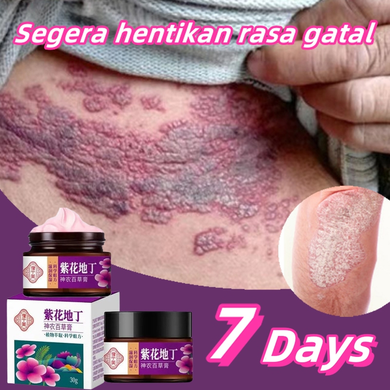 Jual Salep Gatal Paling Ampuh Obat Gatal Obat Gatal Selangkangan Panu ...