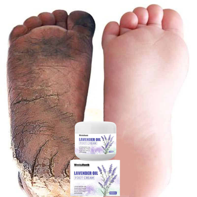 Obat Kaki Pecah Pecah Menghaluskan Melembutkan Kaki dan Tangan Kapalan  Pecah Kasar Kering Foot Heel Cream Krim Penghalus Tumit Kaki