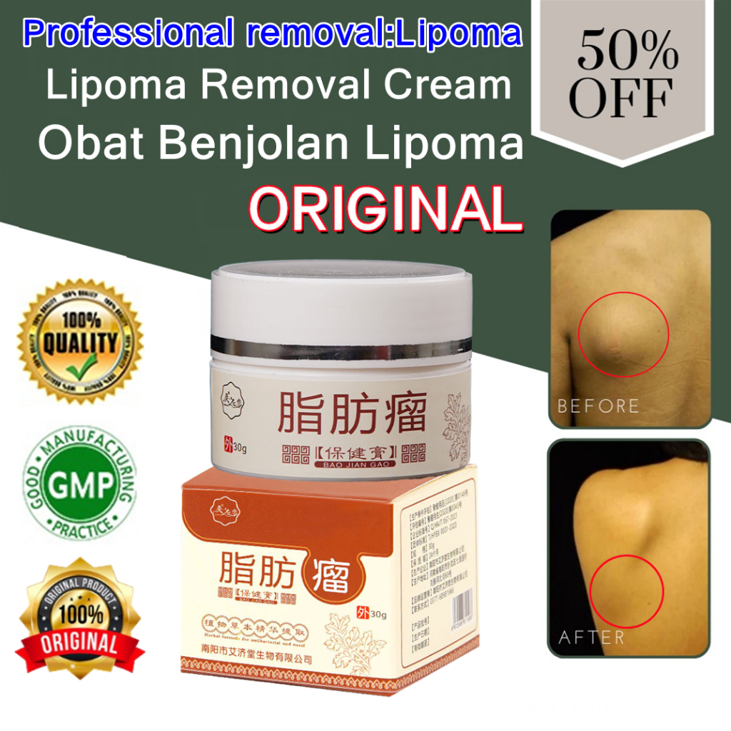 Jual Lipoma Cream 30g Benjolan Salep Benjolan Obat Benjolan Lipoma Benjolan Di Seluruh Tubuh 6307