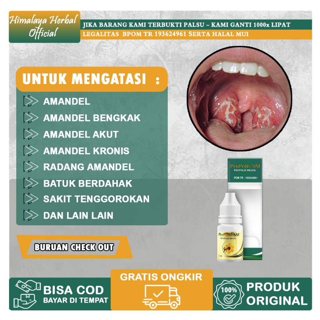 Jual Obat Amandel Untuk Anak Dan Dewasa Sakit Tenggorokan Saat Menelan ...