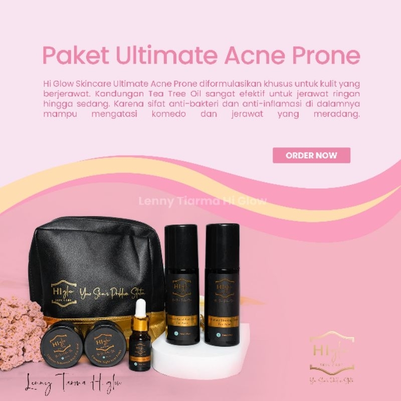 Jual Hi Glow Skincare Ultimate Acne Prone Series Original, Penghilang