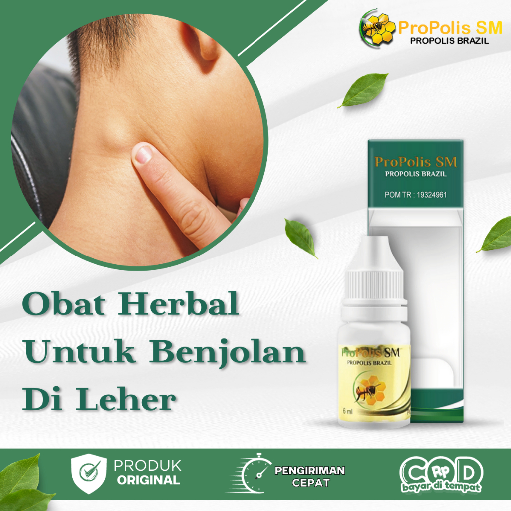 Jual Obat Benjolan Di Leher Kelenjar Getah Bening Kelenjar Tiroid