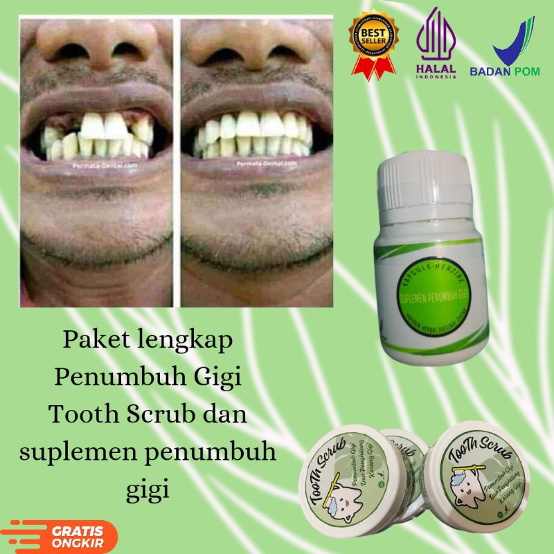 Jual PENUMBUH PENGUAT DAN PEMUTIH GIGI LENGKAP TOOTH SCRUB DAN SUPLEMEN