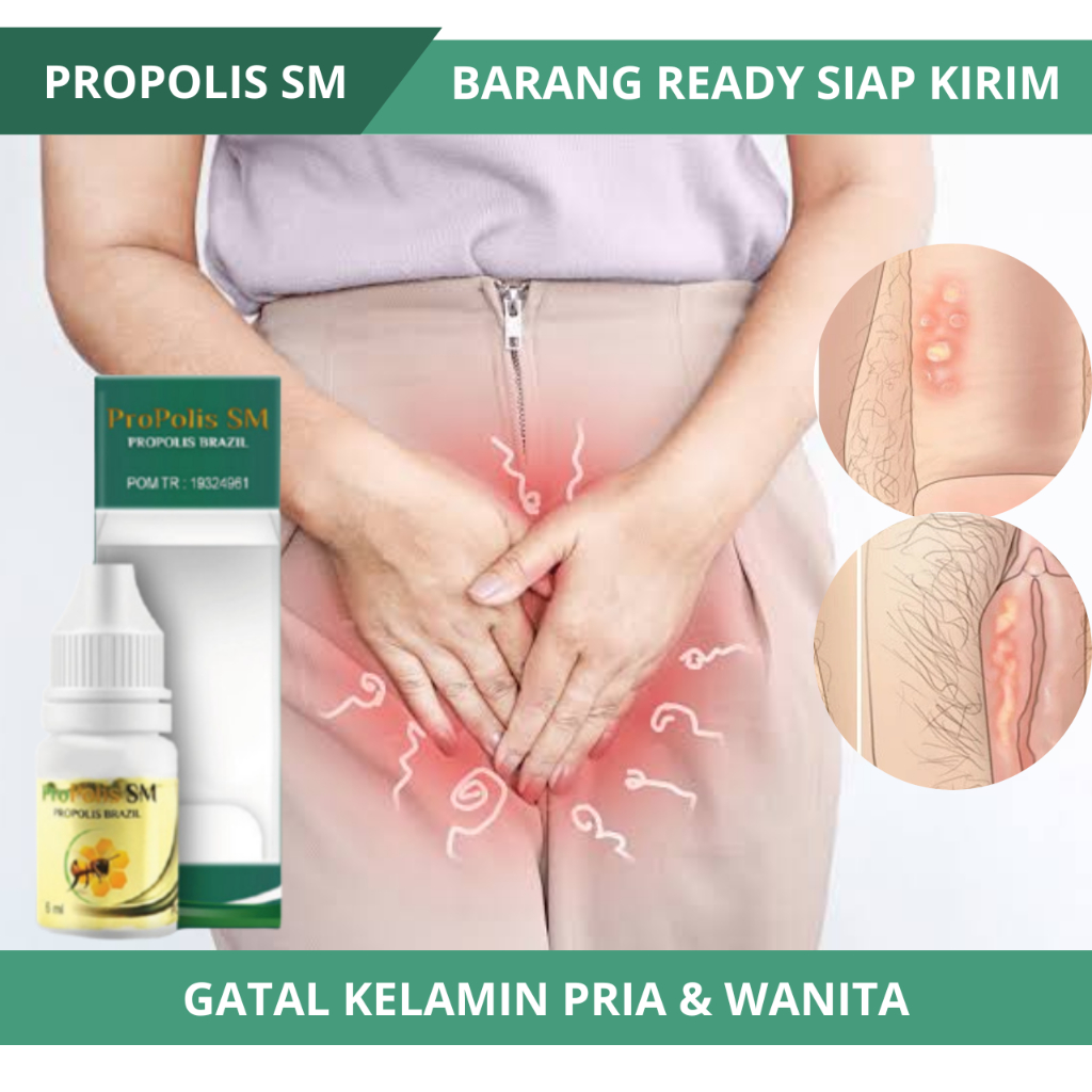 Jual Propolis SM atasi Gatal Kemaluan, Obat Gatal Selangkangan, Obat ...