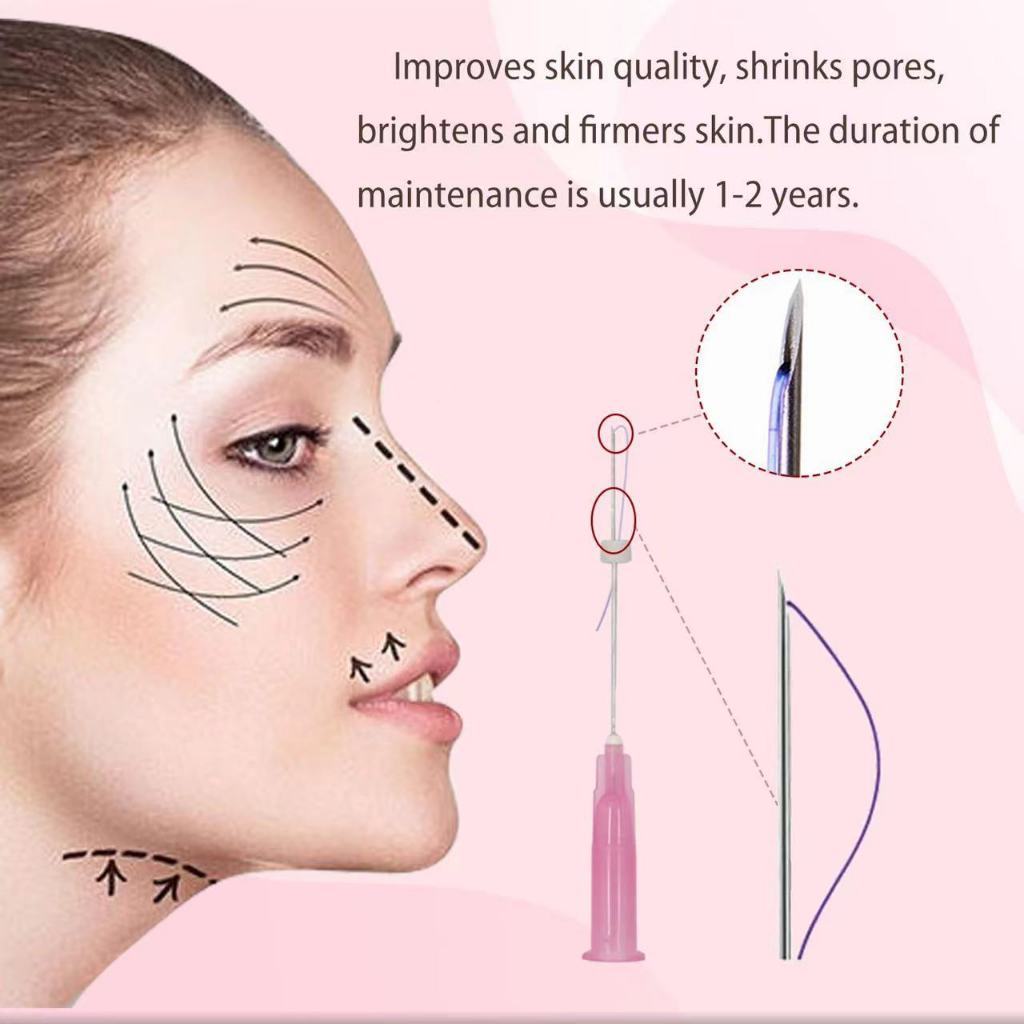 Jual Mono Screw Thread Lift Benang Collagen Tanam Benang Wajah PDO Cog