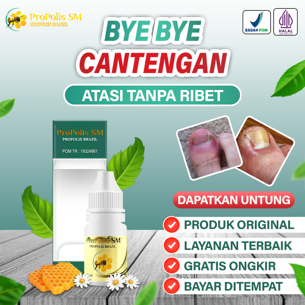 Jual Obat Oles Cantengan Kuku Bernanah Cantengan Di Jempol Kaki