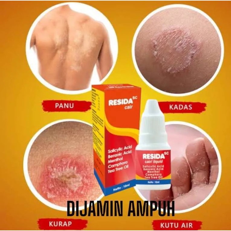 Jual RESIDA CAIR 10 ML(UNTUK PANU KADAS KURAP) | Shopee Indonesia