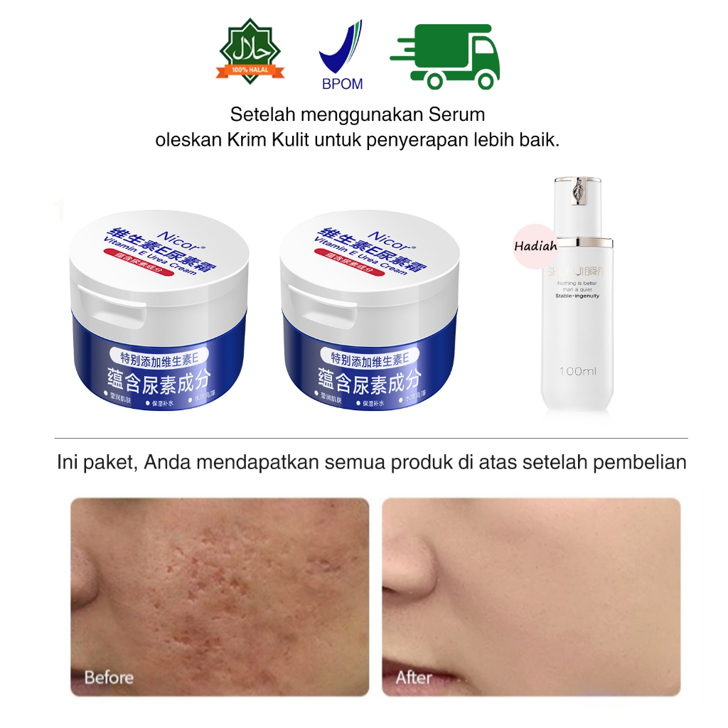 Jual Penghilang Bekas Krim Wajah 100g Obat Lubang Jerawat Penghilang ...