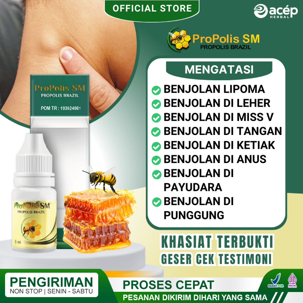 Jual Obat Benjolan Lipoma Di Leher Tangan Payudara Tangan Ketiak Miss V Punggung Dan Anus 9305