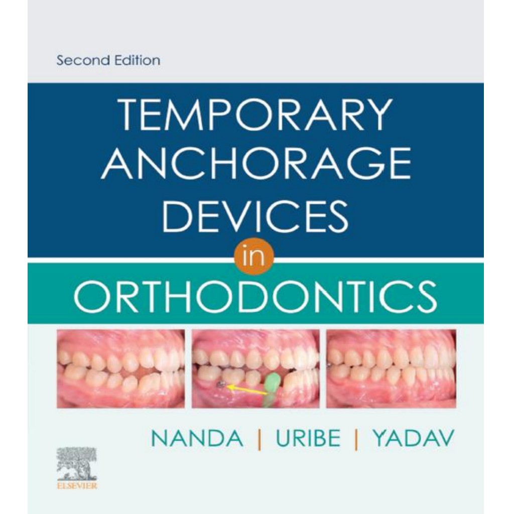 Jual [ENG04] Temporary Anchorage Devices in Orthodontics (Nanda ...