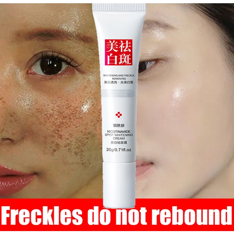 Jual Fuyan Whitening Freckle Cream Remove Dark Spots Anti Freckle Cream Niacinamide Fade