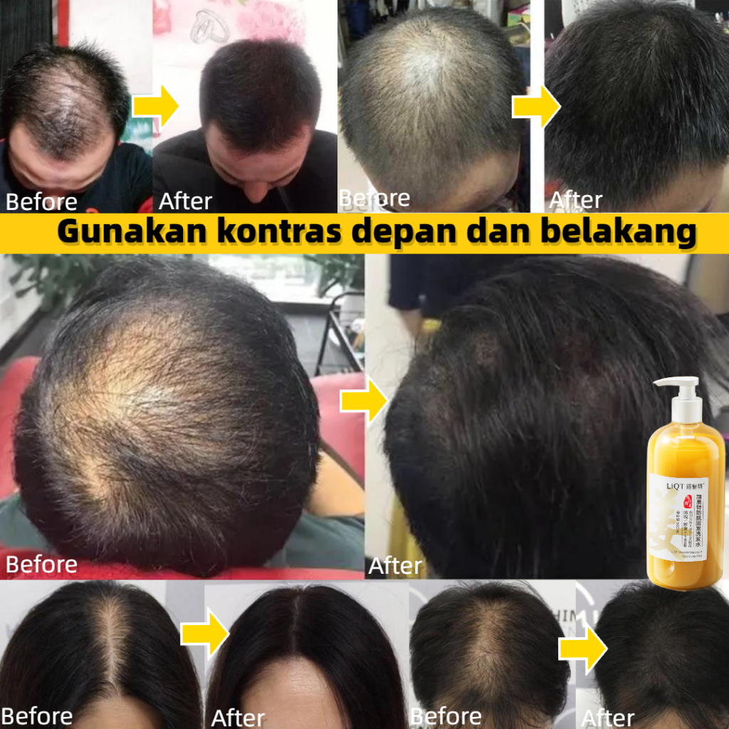 Jual Rambut rontok Shampoo penumbuh rambut cepat shampoo rontok dan ...