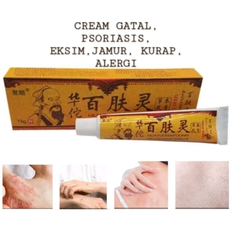 Jual Baifuling Original Salep Cream Gatal Eksim Psoriasis Jamur 8634