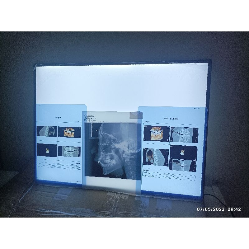 Jual viewer led radiologi lampu baca rontgen uk 42x30 | Shopee Indonesia