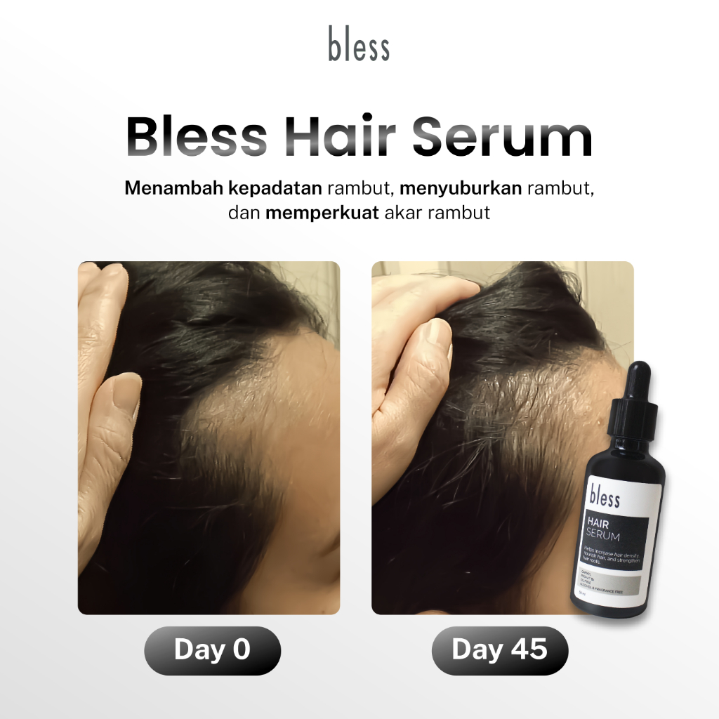 Jual Bless Hair Serum | Serum Rambut Rontok | Shopee Indonesia