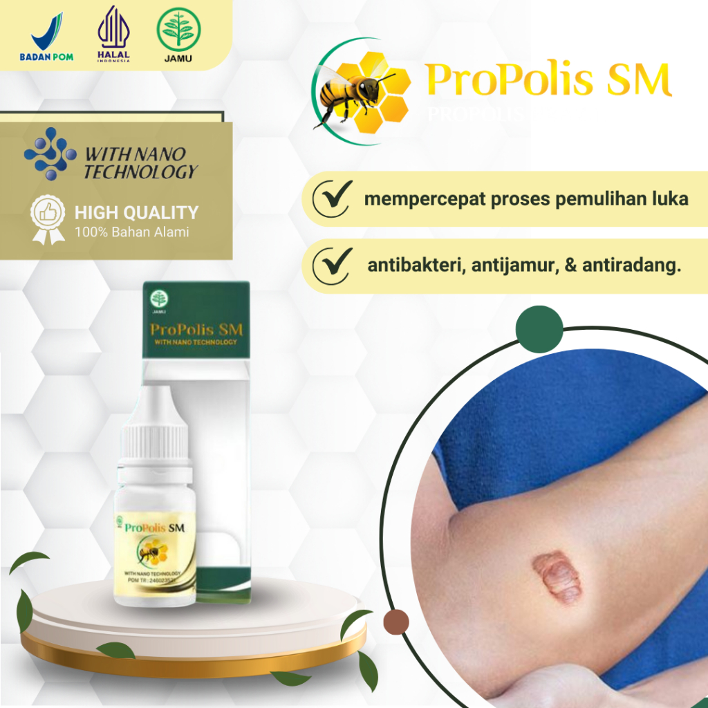Jual Propolis SM - Obat Keloid Bekas Luka Daging Tumbuh Bekas Luka ...