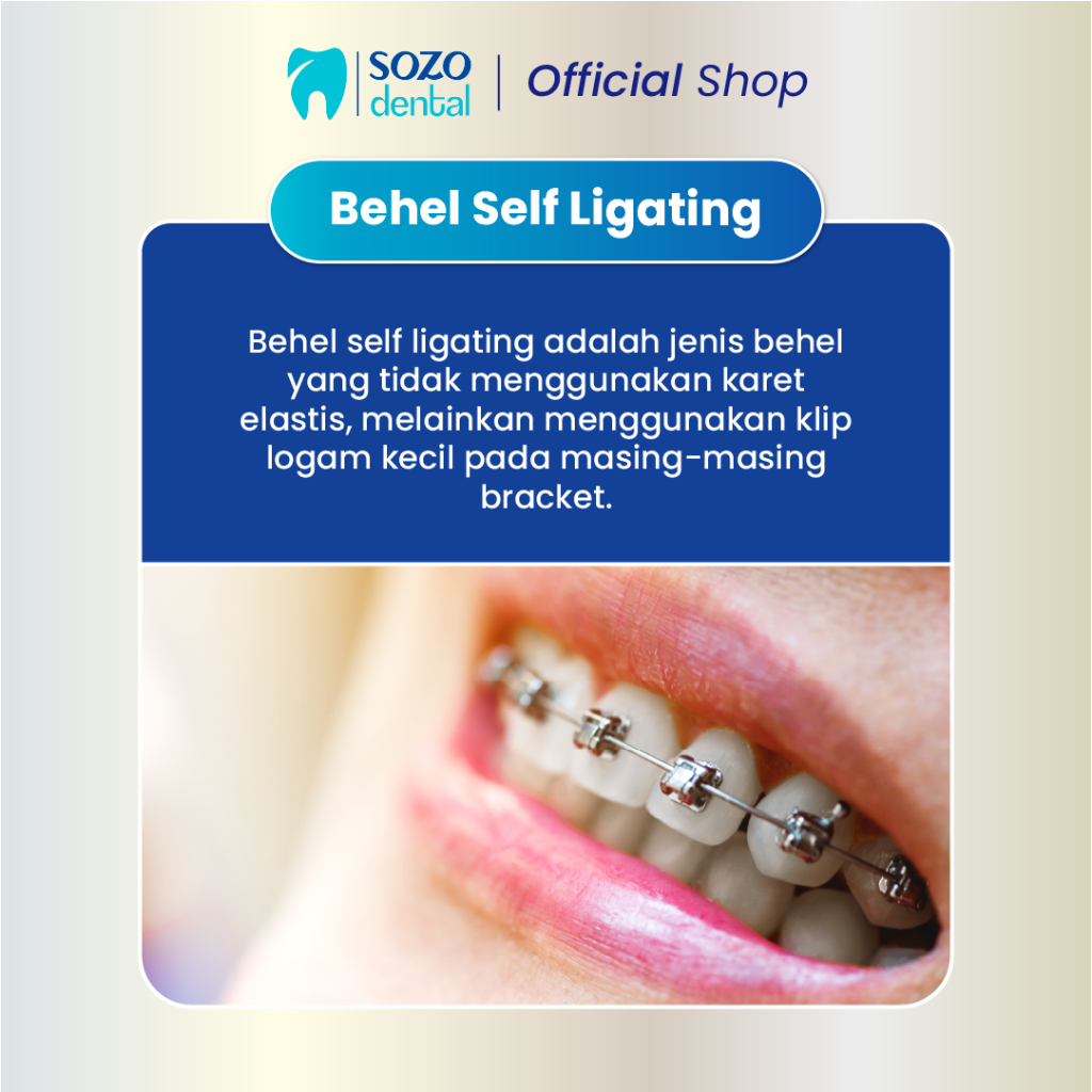 Jual Behel SELF LIGATING (Dokter Gigi Umum): Pemasangan Rahang Atas dan ...