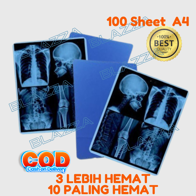Jual Paper Medical Dry Film Digital MCU Radiology DR CR Rontgen X-Ray ...