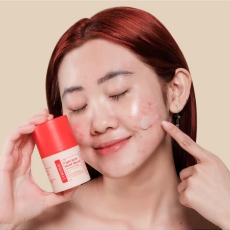 Jual FOREBIE Fight Acne Moist Serum 35ml | Shopee Indonesia
