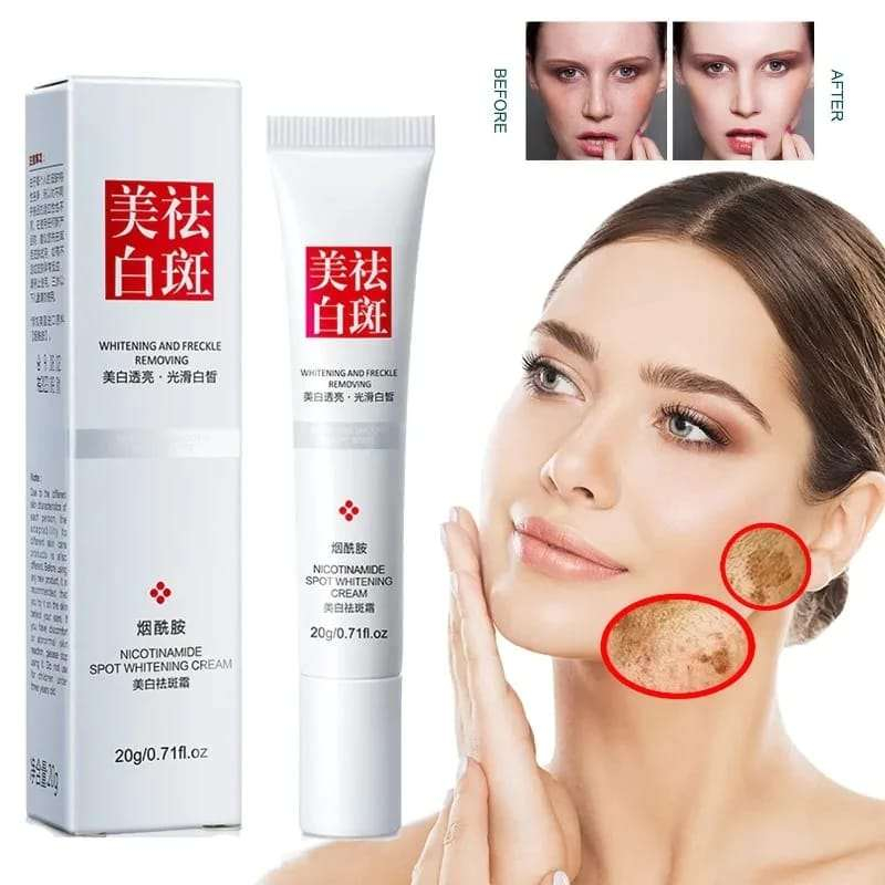 Jual Fuyan Nicotinamide Spot Whitening Cream Fu Yan Whitening And Freckle Removing Andorheal