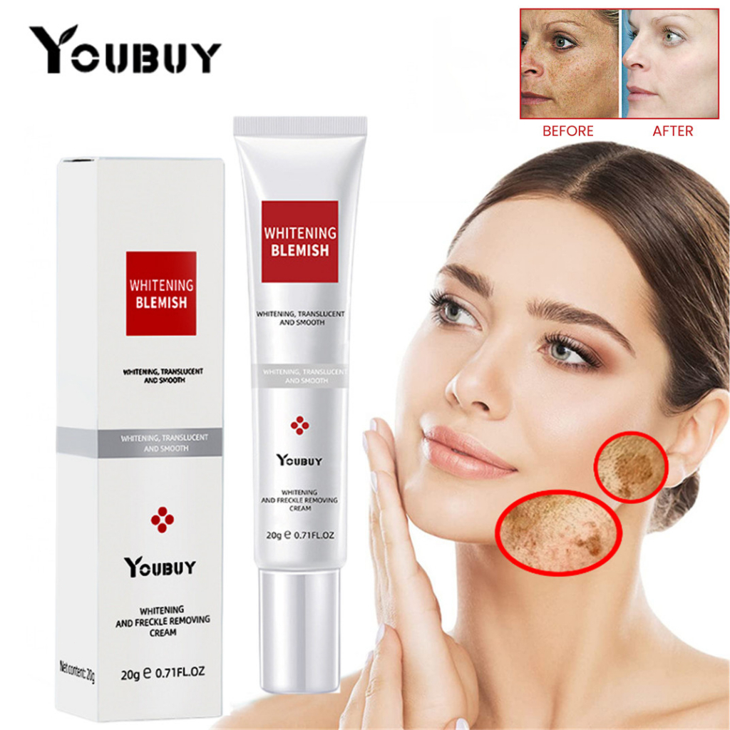 Jual Youbuy Whitening Freckle Cream 20Gr Original Whitening Blemish ...