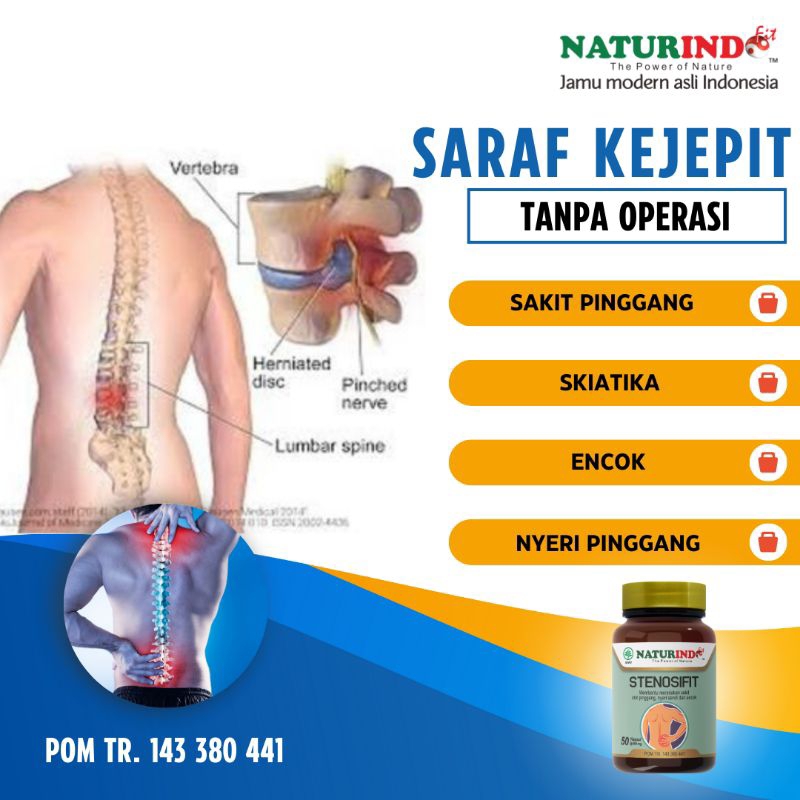 Jual Obat Saraf Kejepit Pinggang Dan Kaki Skiatika Syaraf Terjepit