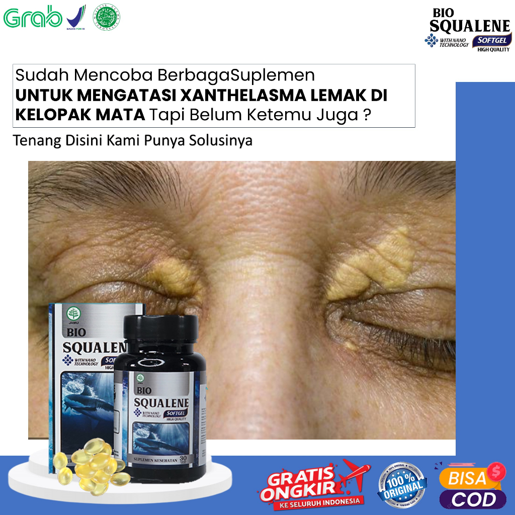 Jual Obat Xanthelasma Penghilang Gumpalan Lemak Di Kelopak Mata Plak