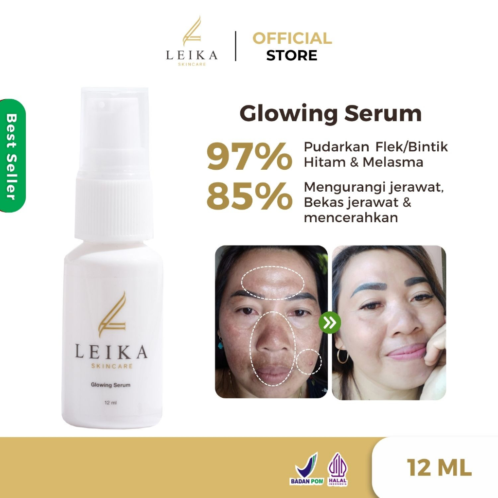 Jual Leika Skincare Glowing Serum Bpom Halal Mui Serum Flek Hitam Di