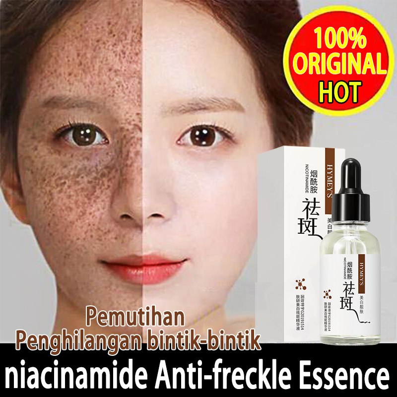 Jual Serum Freckles Remove Nicotinamide Serum Penghilang Flek Serum ...