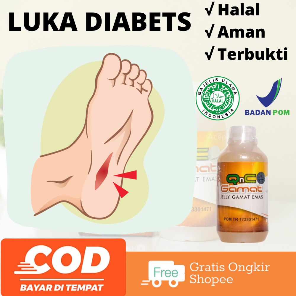 Jual Obat Mengeringkan Luka Diabetes, Pengering Luka Penderita Diabetes