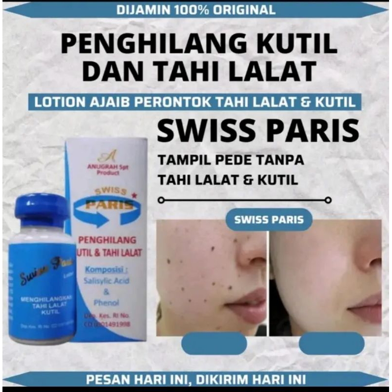Jual Swiss Paris Penghilang Tahi Lalat Bpom Resmi Shopee Indonesia