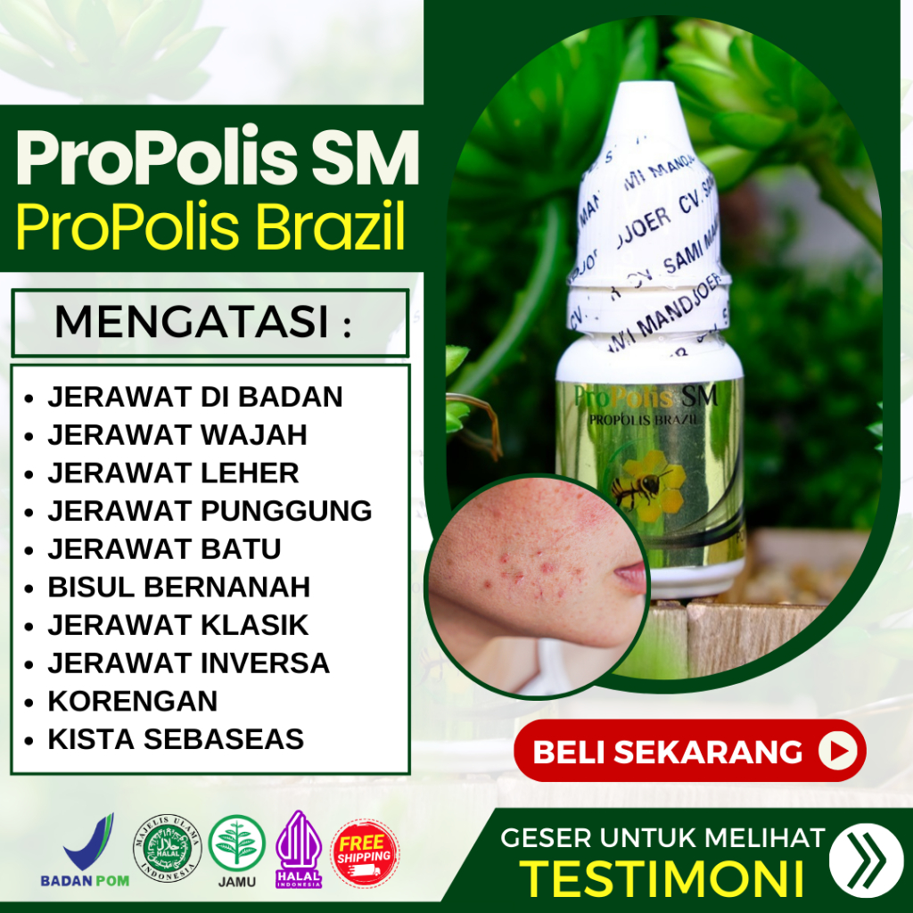 Jual Obat Penghilang Jerawat di Badan, SALEP Jerawat Di Badan, Obat