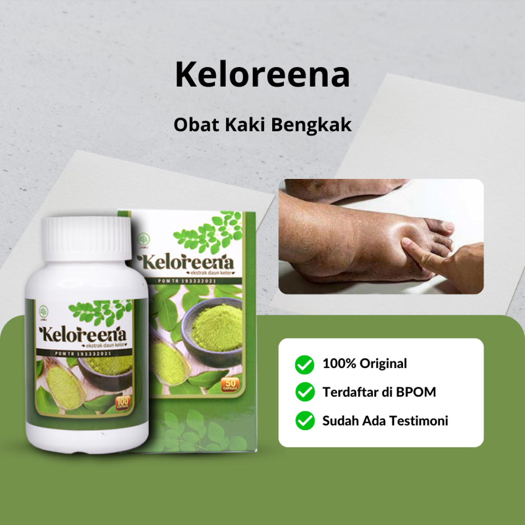 Jual Keloreena - Obat Kaki Bengkak Karena Diabetes Edema Penumpukan