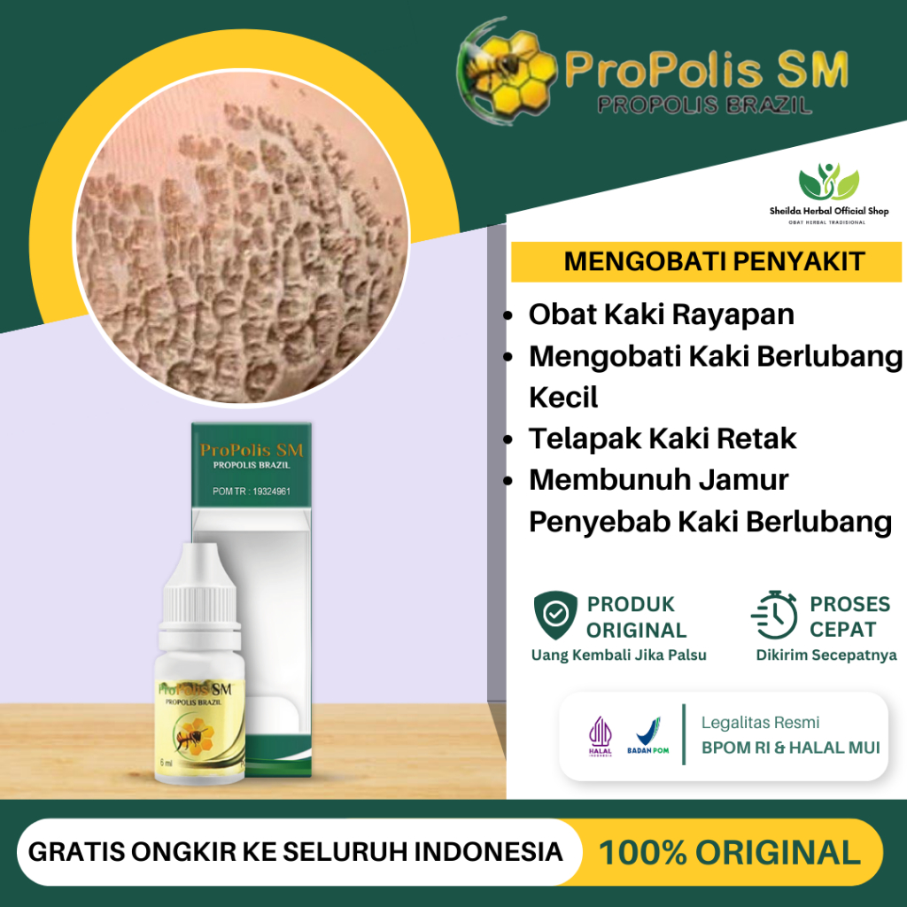 Jual Obat Telapak Kaki Rayapan Infeksi Jamur Kaki Berlubang Kaki