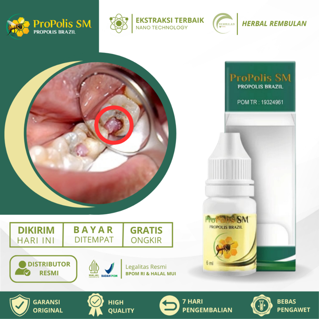 Jual Obat Polip Pulpa Gigi Obat Polip Gigi Benjolan Gusi Sakit Gigi