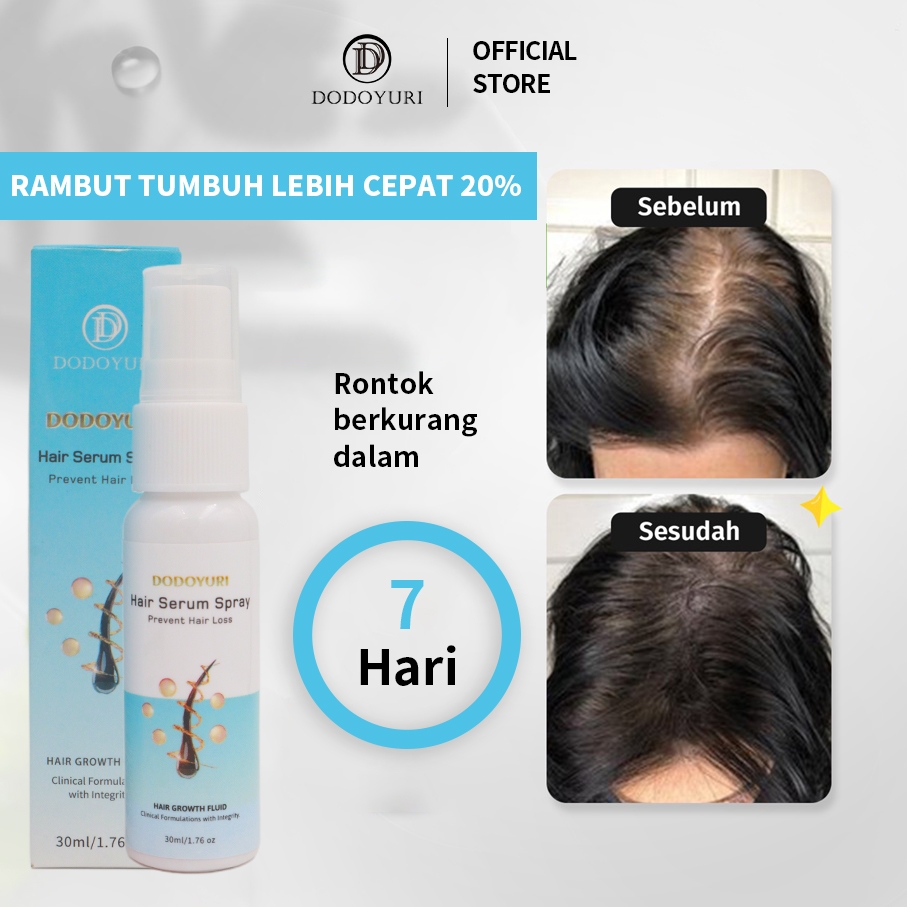 Jual [BPOM] Penumbuh rambut cepat obat penumbuh rambut serum penumbuh ...